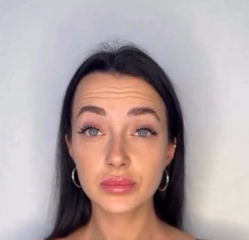 Botox 9$ instead of 12$ Limited Time Offer