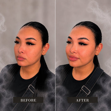 Natural Lip Enhancement