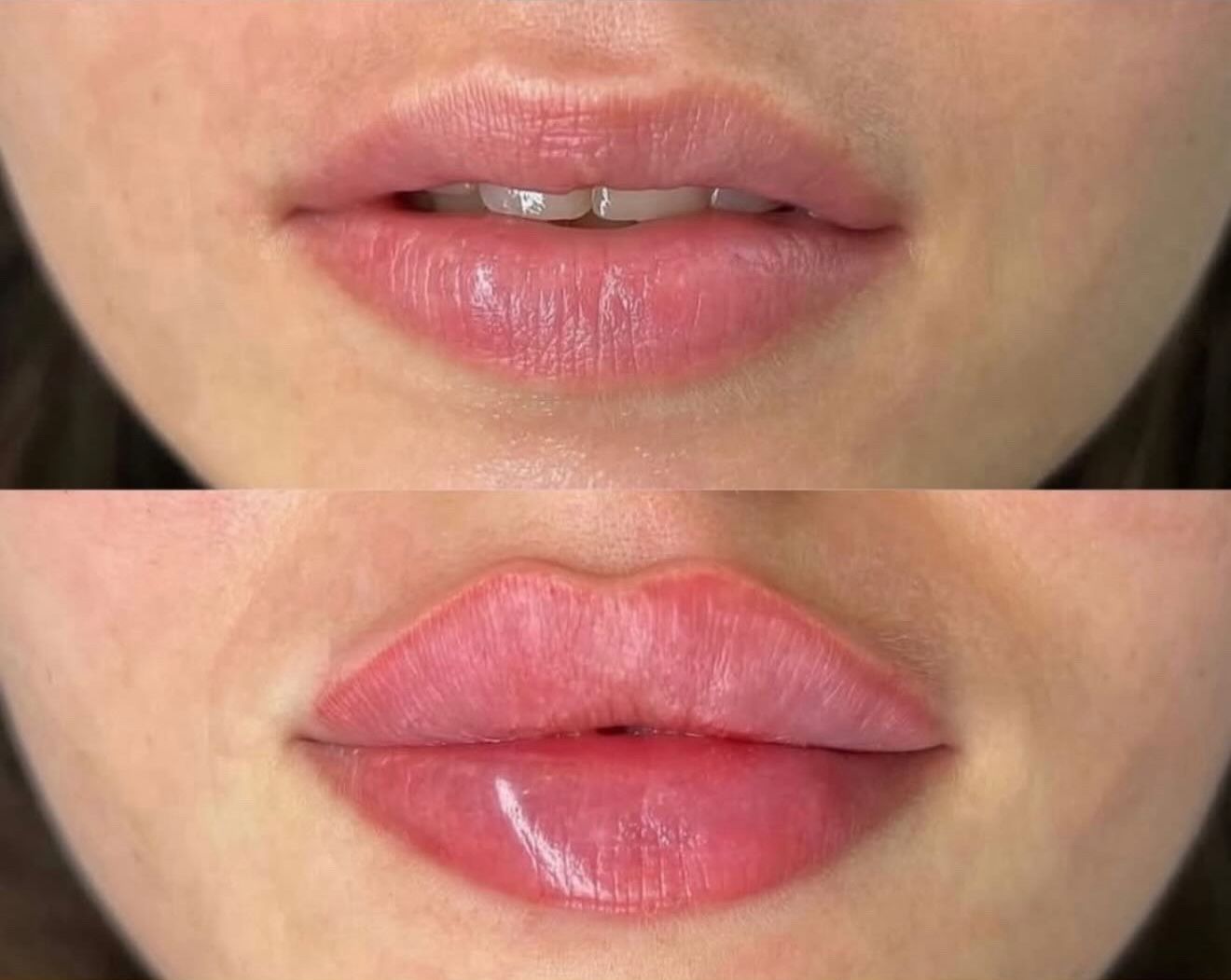 Russian Lip Technique