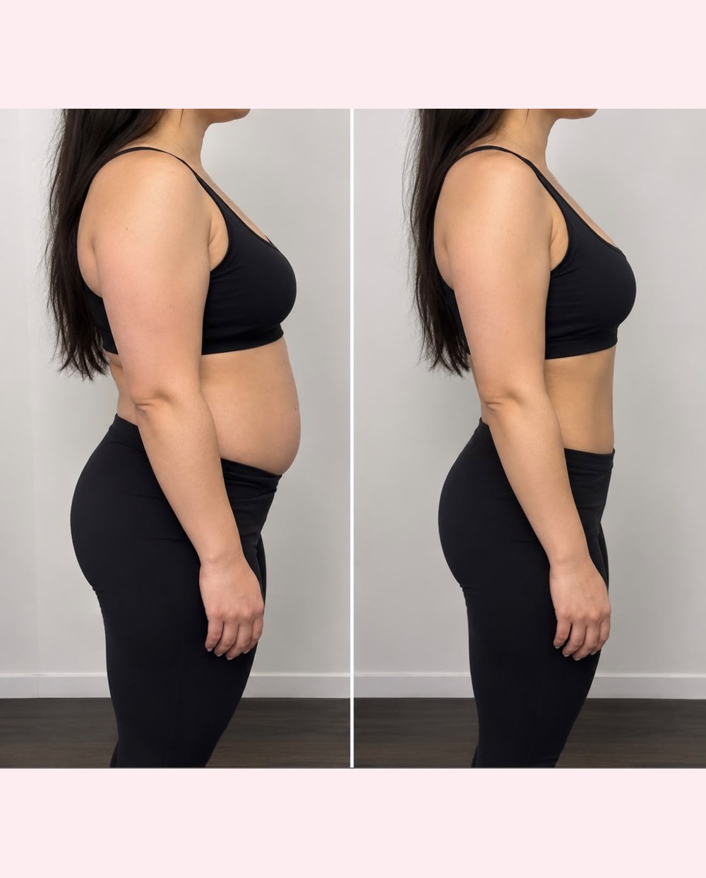 Before and after a medically supervised weight loss programme at Glow by Phoebe