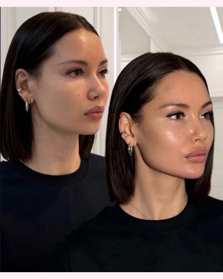 Before and after skin treatment at Glow by Phoebe