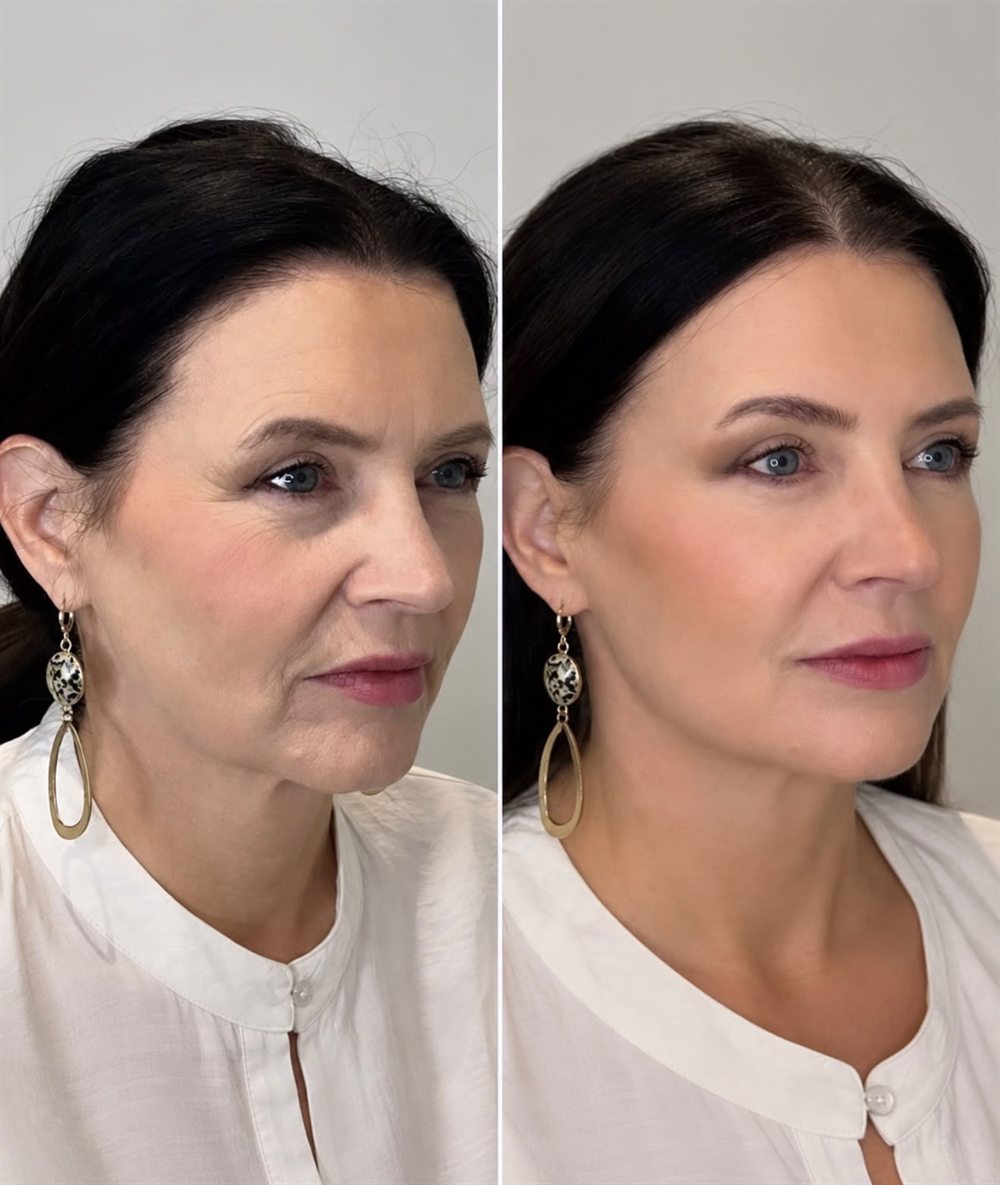 Before and after at Glow by Phoebe